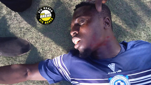 Yeşil sahalarda akılalmaz olay: Taraftar futbolcunun boğazını kesti, hakem maçı kaldığı yerden devam ettirdi!